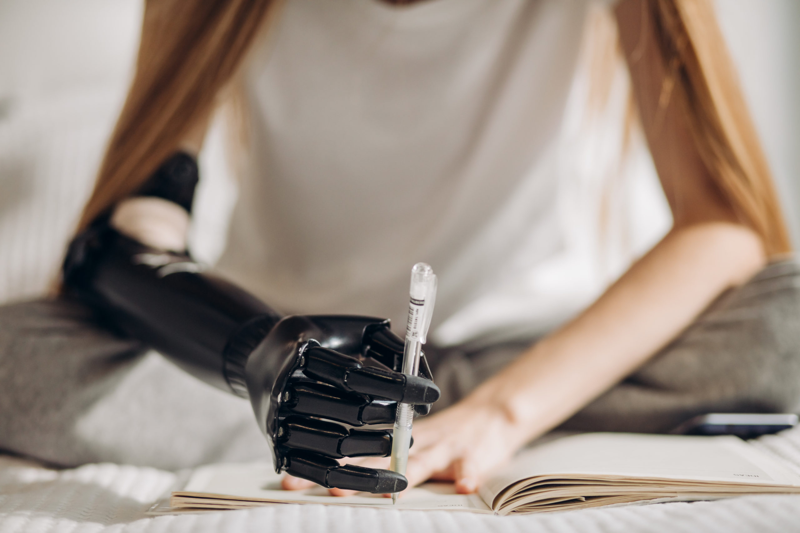 Armprothese